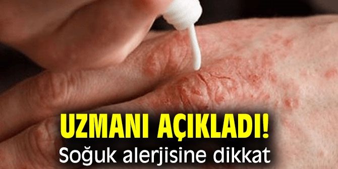 SOĞUK HAVALARDA SOĞUK ALERJİSİNE DİKKAT 