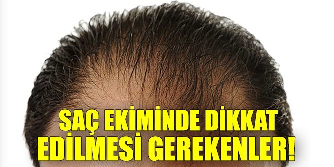 SAÇ EKİMİ ÖNCESİ  UYULMASI GEREKEN KURALLAR