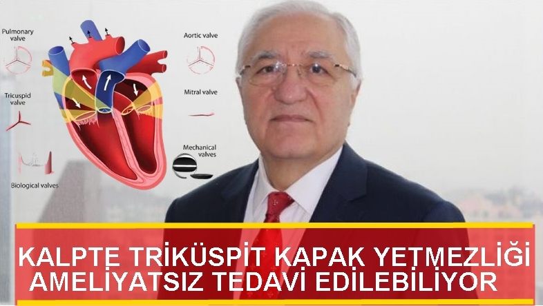 KALPTE TRİKÜSPİT KAPAK YETMEZLİĞİ AMELİYATSIZ TEDAVİ EDİLEBİLİYOR