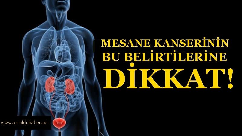 Mesane Kanserinin Belirtilerine Dikkat!