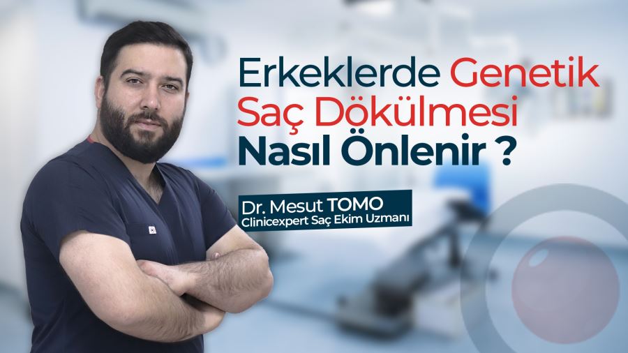 Erkeklerde Genetik Saç Dökülmesi Nasıl Önlenir? 