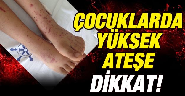 ÇOCUKLARDA DÜŞMEYEN ARTEŞE DİKKAT!