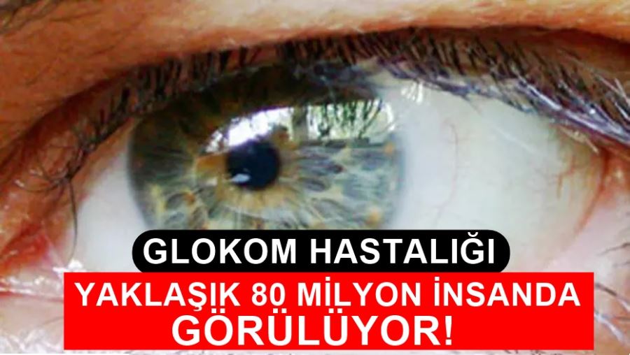 Glokom Hastalığı Yaklaşık 80 Milyon Kişide Görülüyor! 