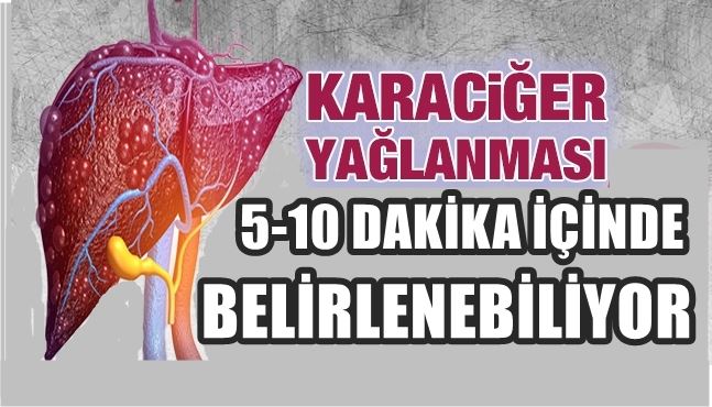 KARACİĞERDEKİ YAĞLANMA 5-10 DAKİKA İÇİNDE BELİRLENEBİLİYOR