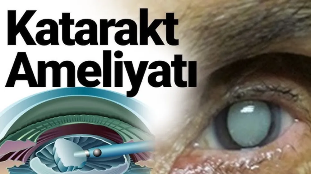 KataraktAmeliyatı Bunama Riskini Azaltabilir...