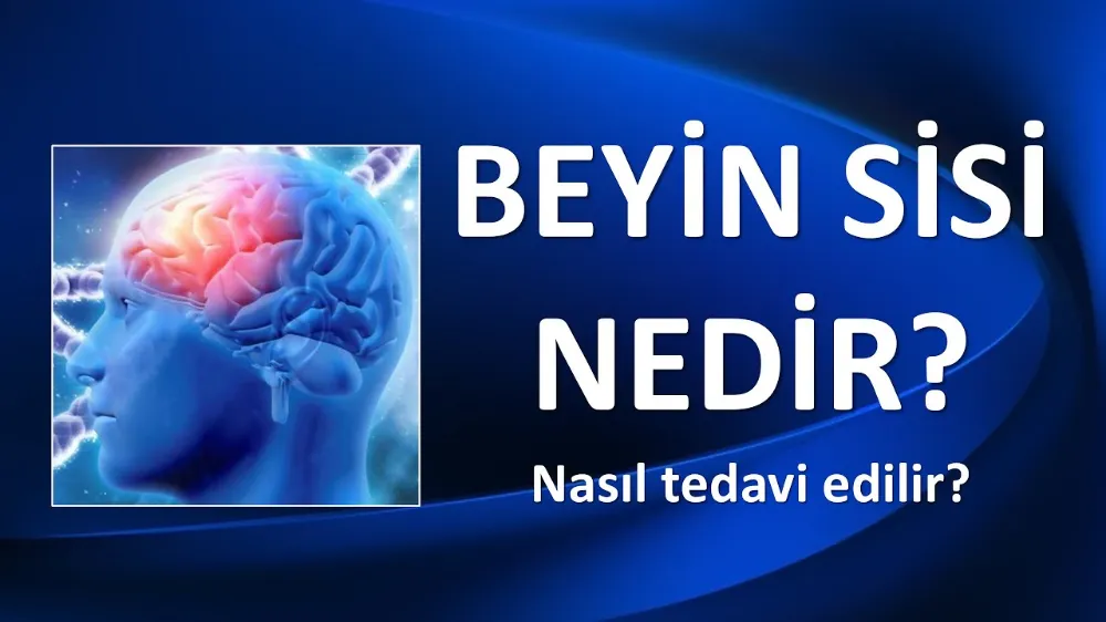 BEYİN SİSİ HAKKINDA BİLİNMESİ GEREKENLER