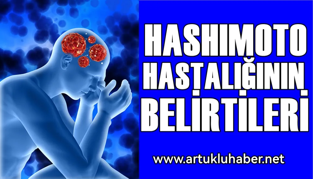 HASHIMOTO  HASTALIĞININ BELİRTİLERİ